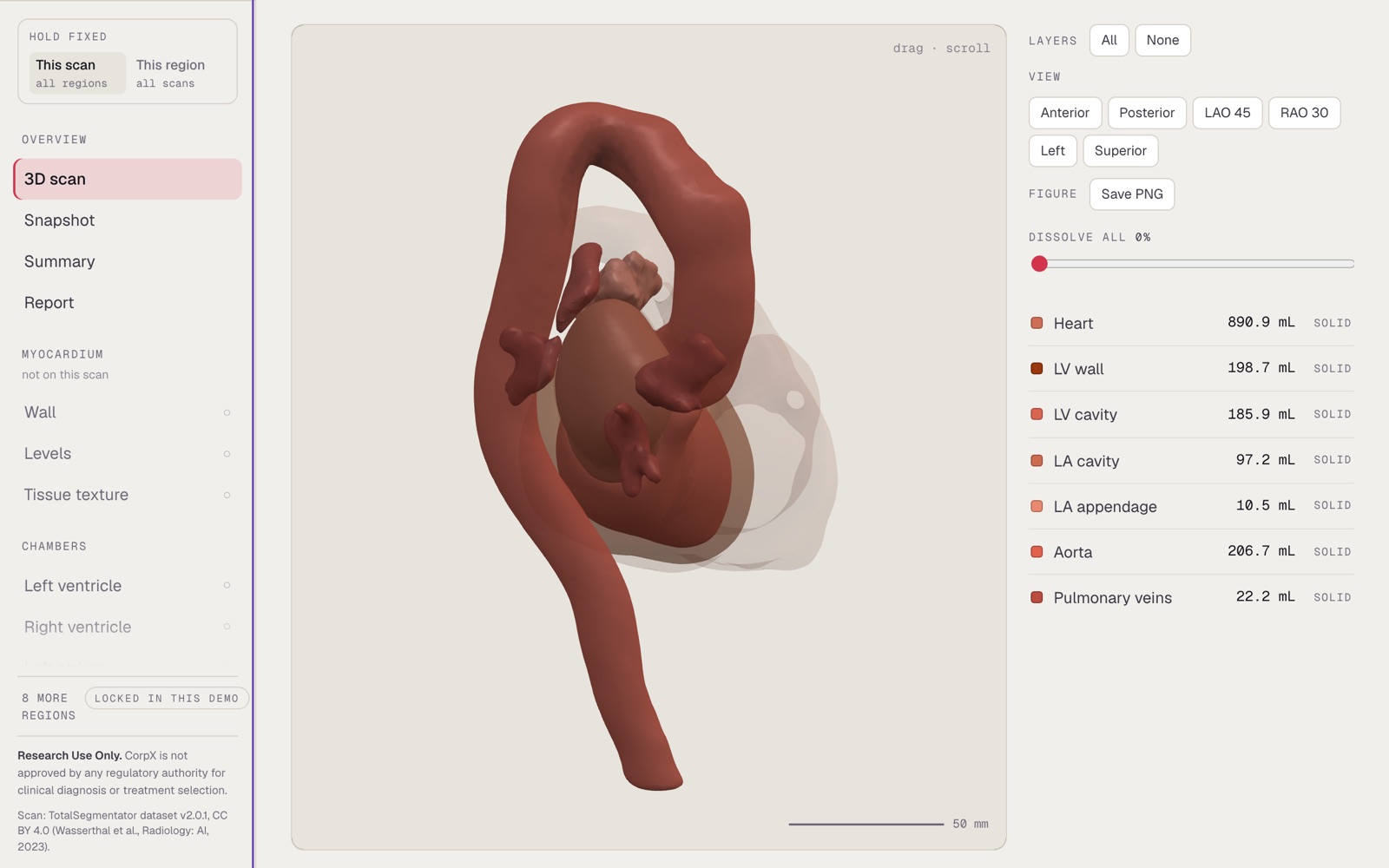 The CorpX HeartX scan page: the region rail on the left, the 3D anatomy view and its measured volumes on the right